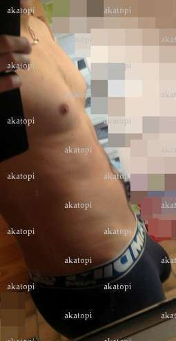 akatopi - Homme candaulisme - Strasbourg