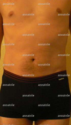 annatole - Homme mélangiste - Avranches