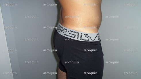 arcoquin - Homme candaulisme - Gujan-Mestras