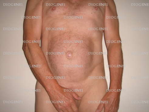 DIOGENE1 - Homme mélangiste - Arles