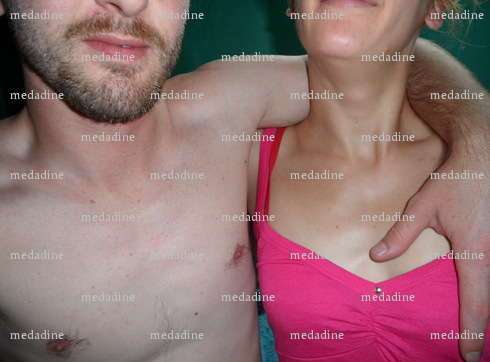 medadine - Couple échangiste - Valenciennes