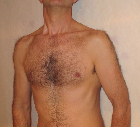 papillon1 - Homme coquin - Baldersheim